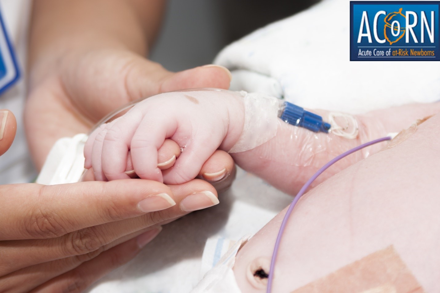 Acute Care Of At Risk Newborns Acorn